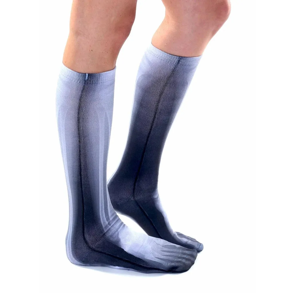 X-Ray