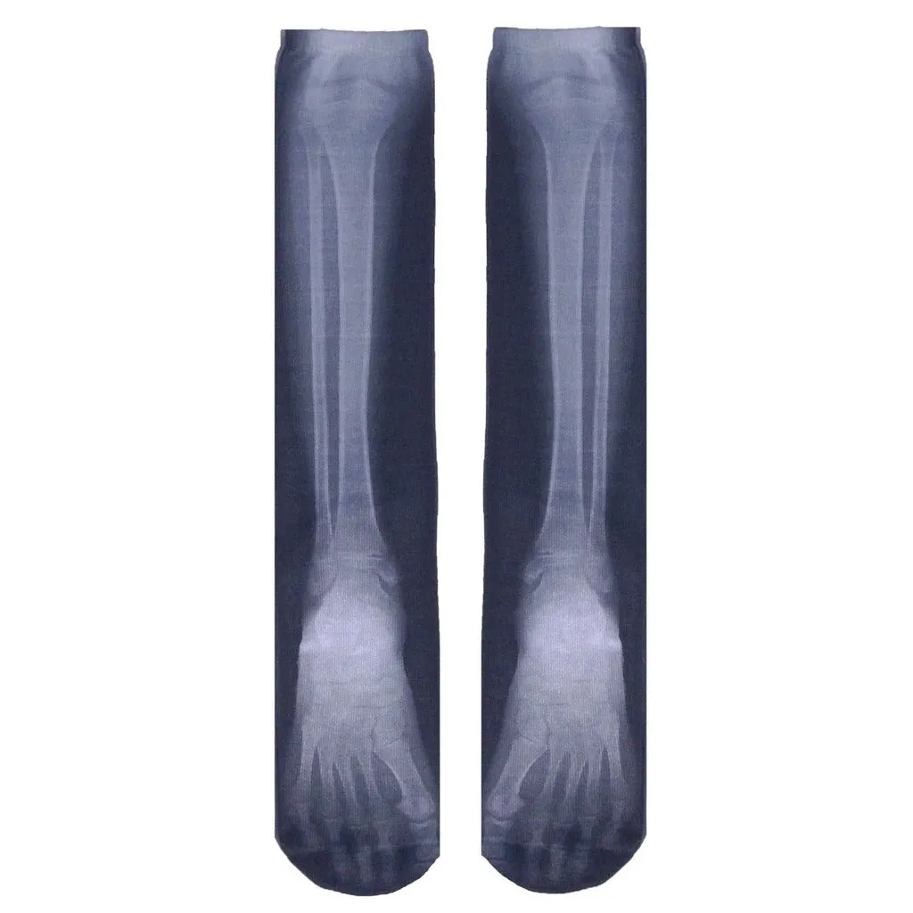 X-Ray